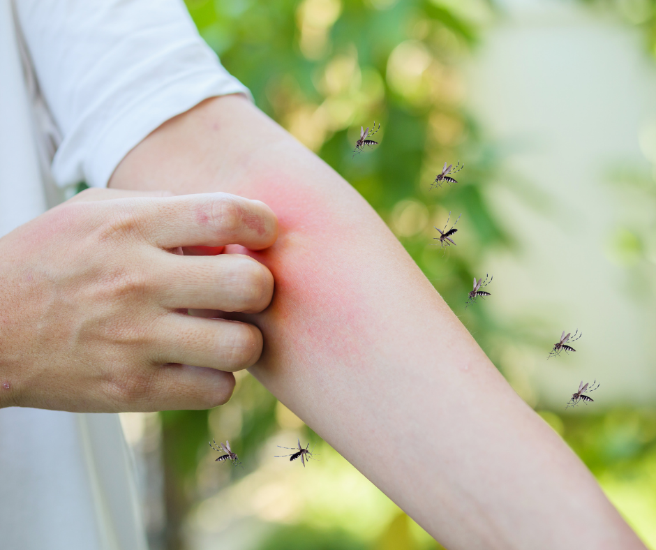 person itching arm from mosquitos